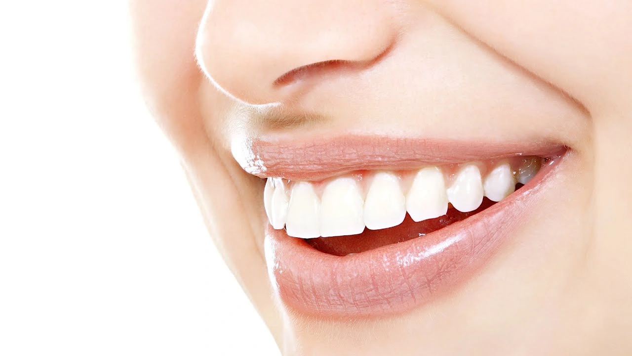 Teeth-Whitening-Process (1)