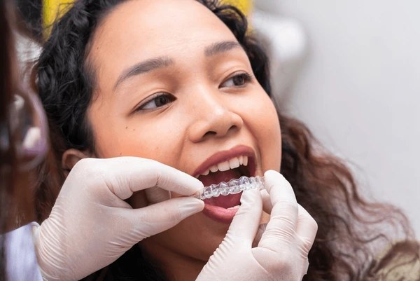 Invisalign clear aligners straightening teeth in Aubrey TX without traditional braces