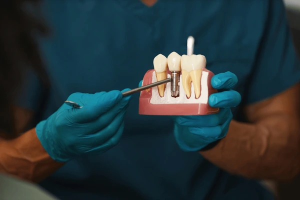 Dental implant replacing a missing tooth at a dentist in Aubrey, TX